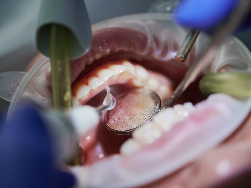 Periodontoloji